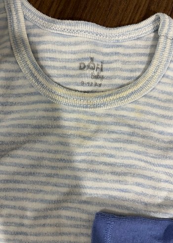 Mavi Kısa Kollu Bebek Body Seti - Görsel 3