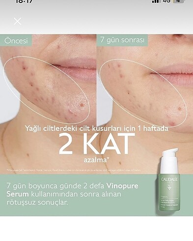 Caudalie Yüz Serumu Salisilik Asit - Görsel 5