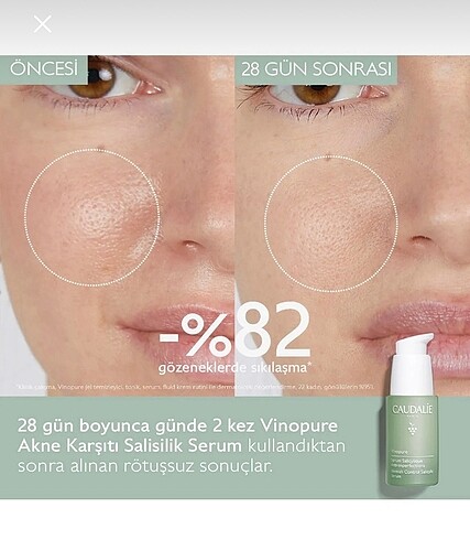 Caudalie Yüz Serumu Salisilik Asit - Görsel 6