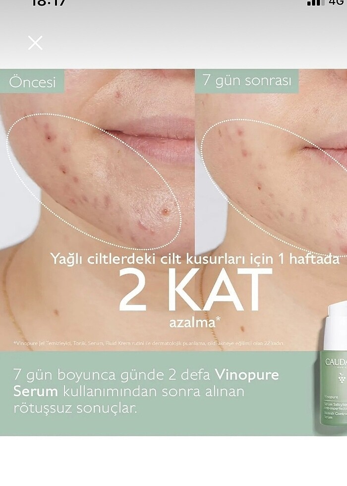 Caudalie Yüz Serumu Salisilik Asit - Görsel 5