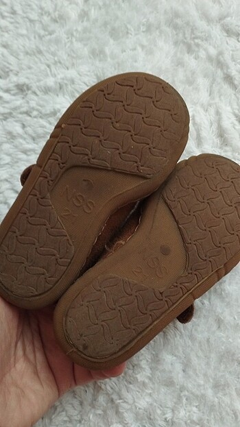 E bebekten alınma ortopedik - Görsel 4