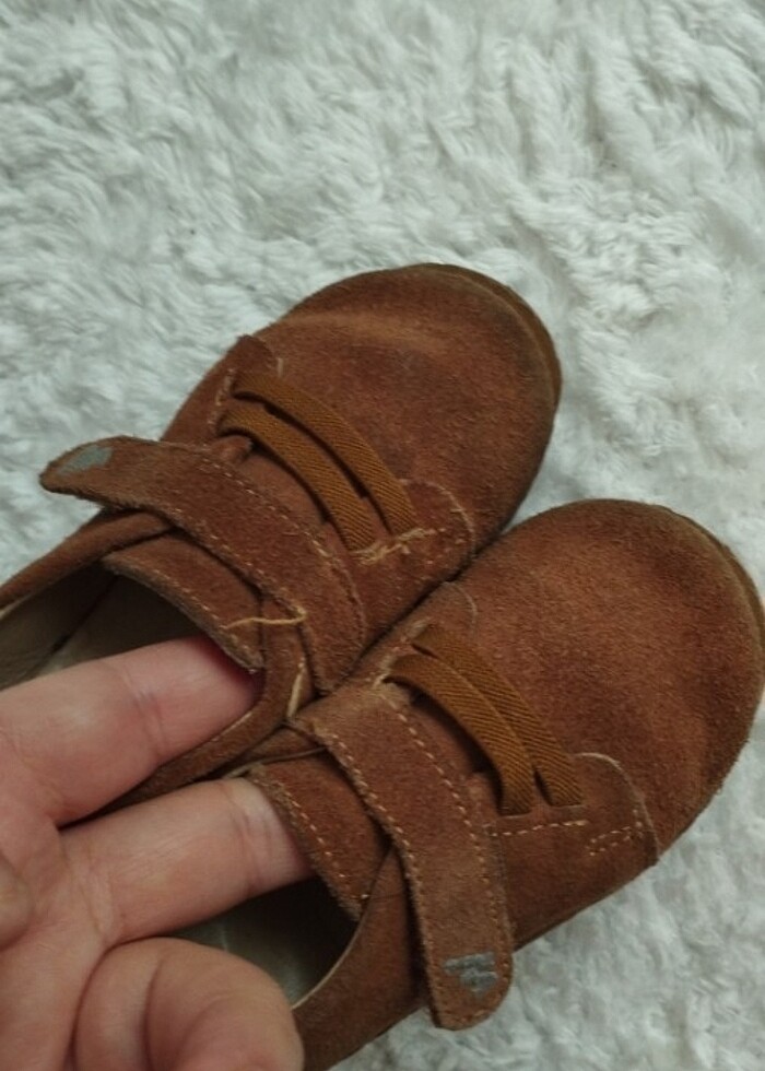 E bebekten alınma ortopedik - Görsel 5