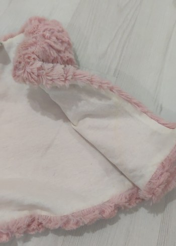Kız Çocuk Pembe Kürklü Kolsuz Yelek - Görsel 3