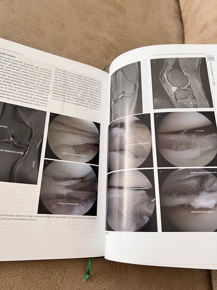 Ortopedi kitabı - Görsel 3