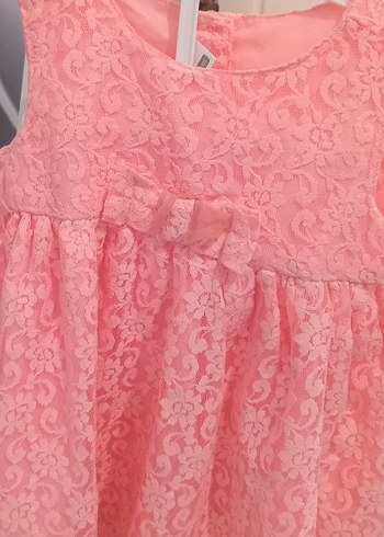Dantel Detaylı Pembe Kız Çocuk Elbise - Görsel 2