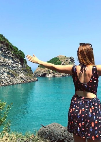 Desenli V Yaka Düğmeli Mini Elbise - Görsel 5