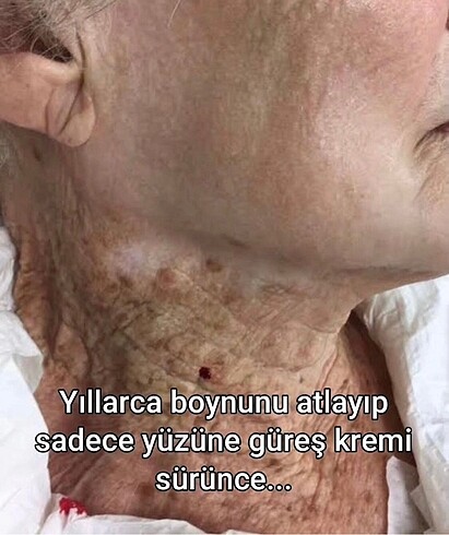 Bioderma GÜNEŞ KREMİ