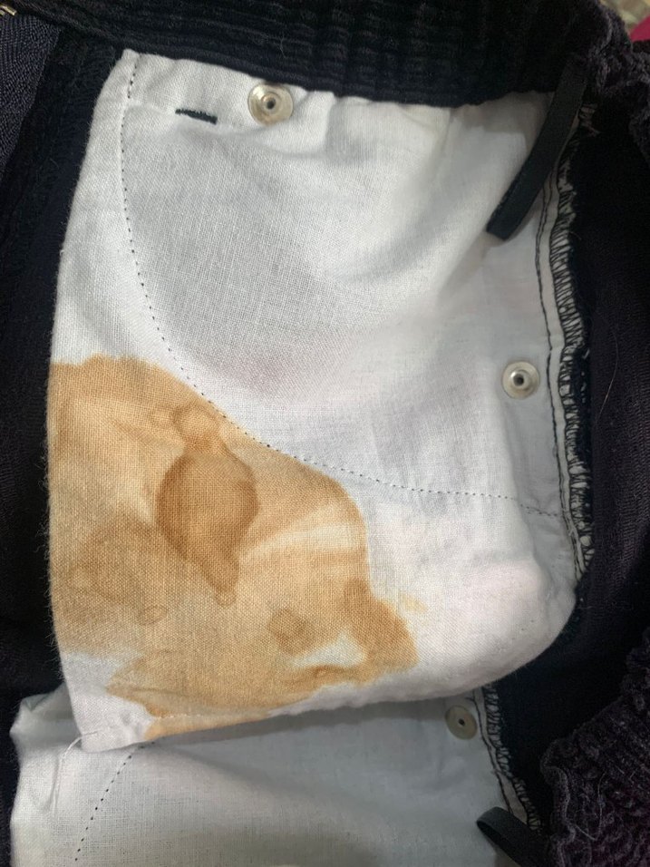 Siyah Kadife Düğmeli Kız Etek - Görsel 5