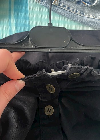 Düğmeli Siyah Mini Etek - Görsel 4