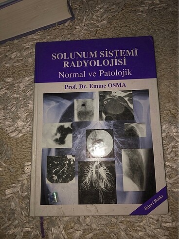 Solonum sistemi radyolojisi