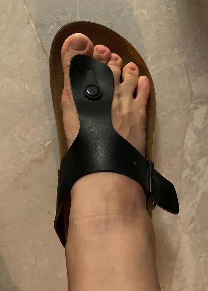 Parmak arası terlik - Görsel 2