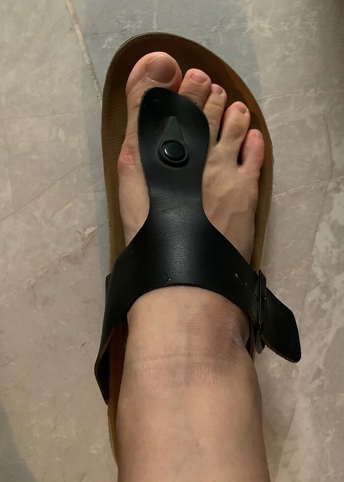 Parmak arası terlik - Görsel 3