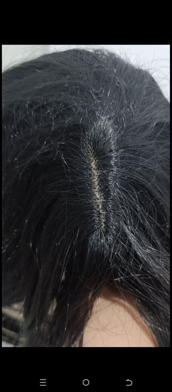 kahkullu peruk - Görsel 2