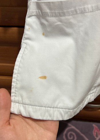 Notus Düğmeli V Yaka scrubs - Görsel 2