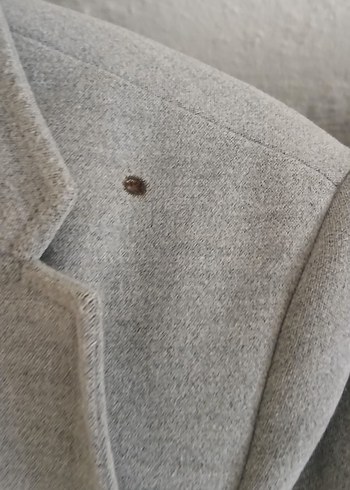 Gri Erkek Midi Uzunlukta Düğmeli Ceket - Görsel 3