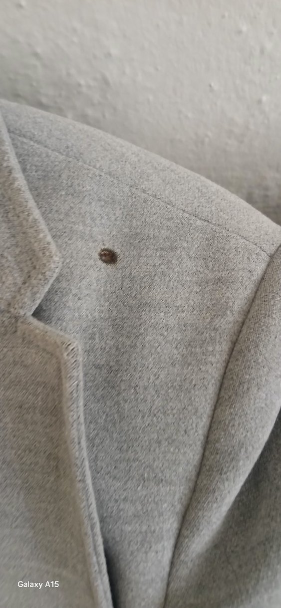 Gri Erkek Midi Uzunlukta Düğmeli Ceket - Görsel 3