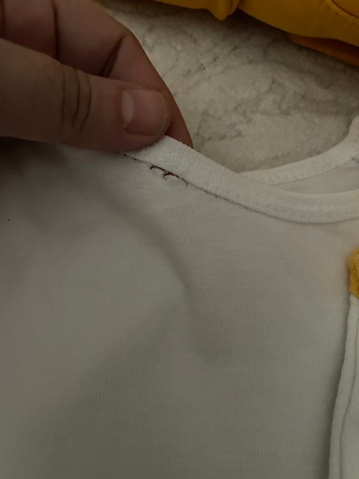 Sarı Soket Baskılı Bebek Body - Görsel 2