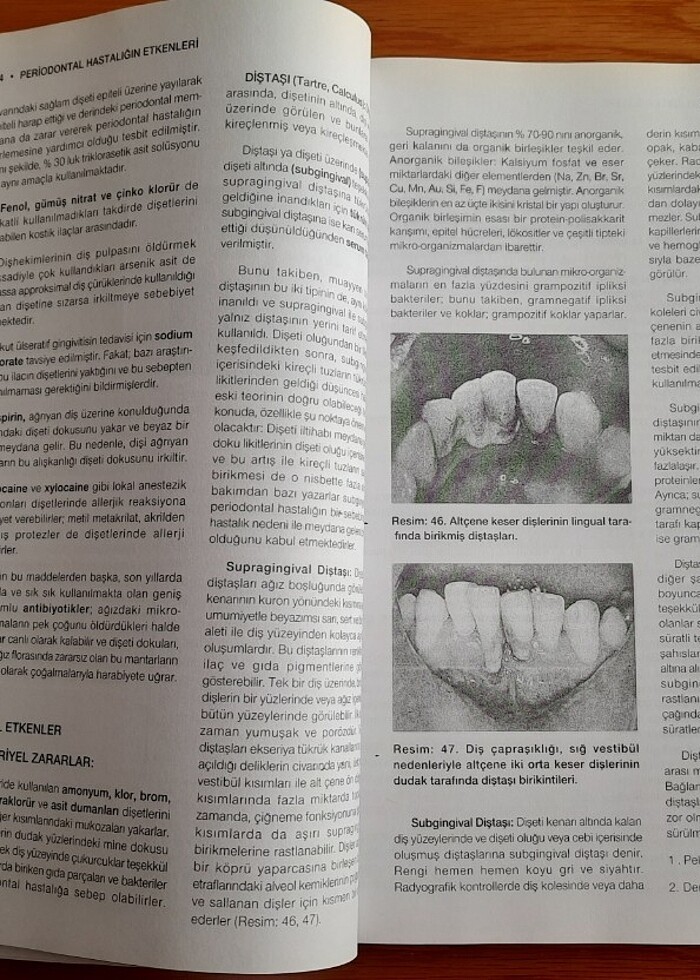 Periodontoloji -Prof. Dr. Peker Sandallı - Görsel 2