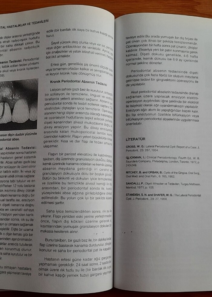 Periodontoloji -Prof. Dr. Peker Sandallı - Görsel 4