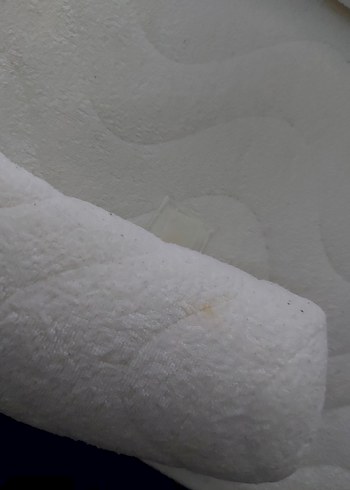 REFLÜ YATAĞI - Görsel 3