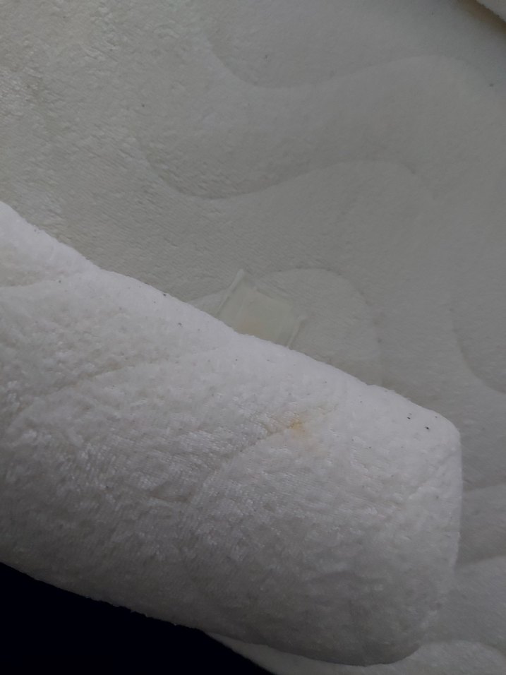 REFLÜ YATAĞI - Görsel 3