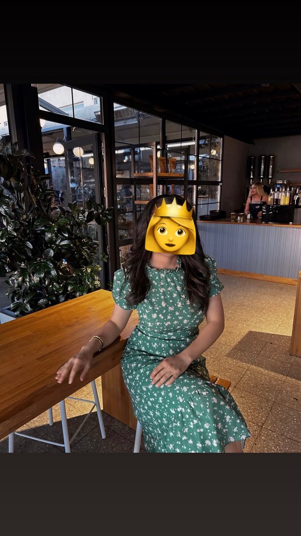 Yeşil Midi Günlük Elbise - Görsel 2