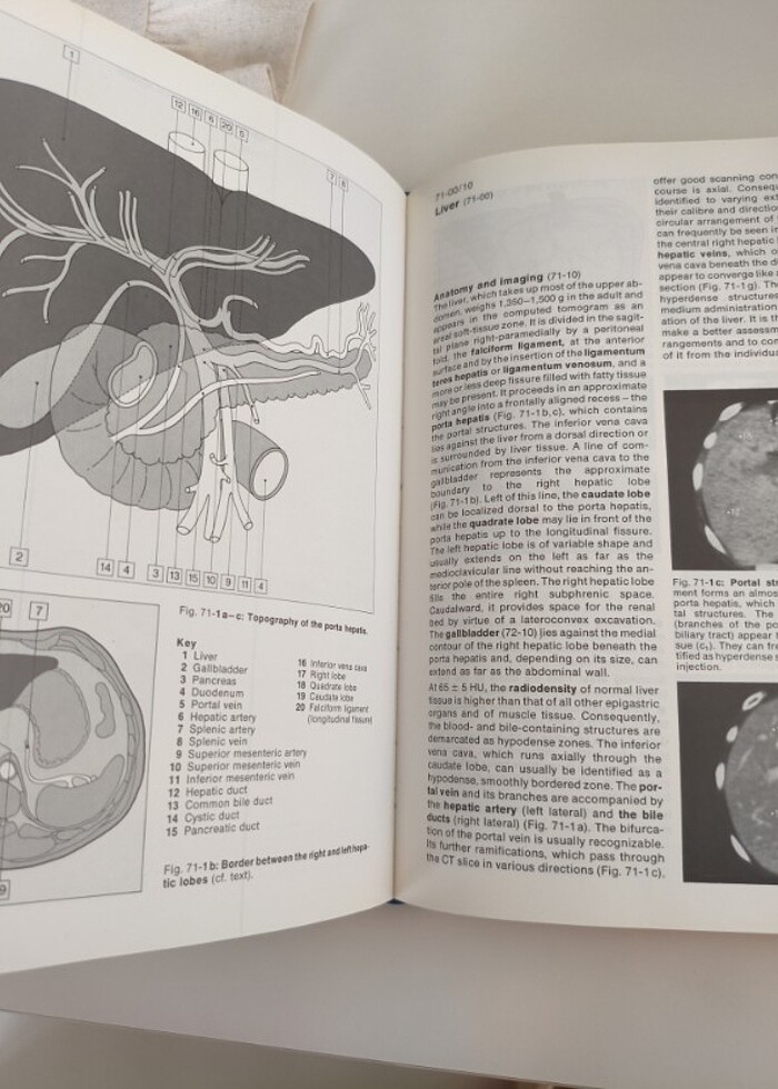Tüm vücut tomografi  - Görsel 2