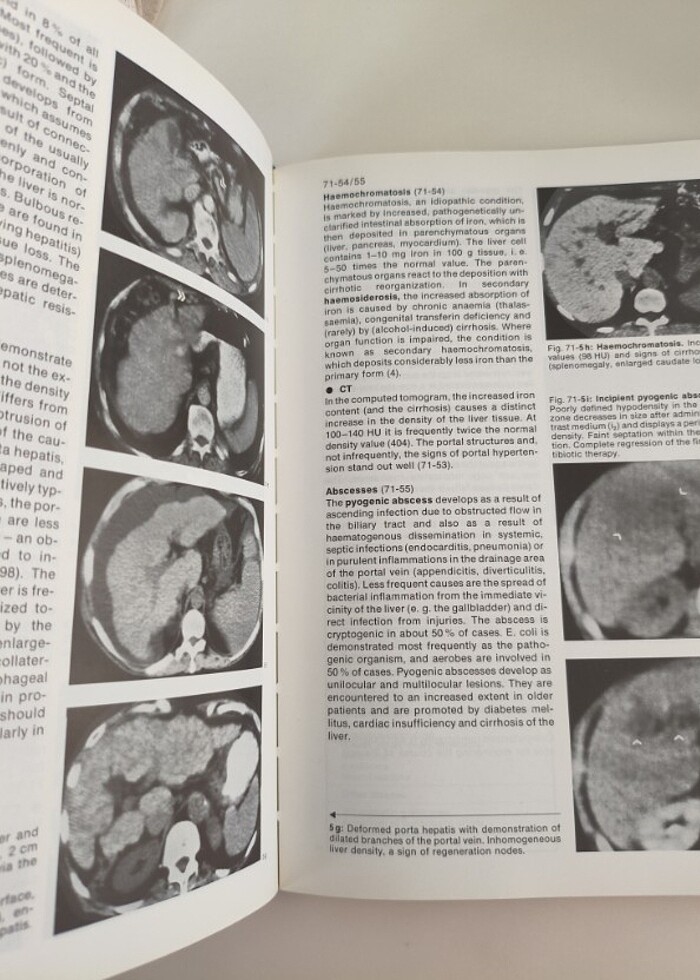 Tüm vücut tomografi  - Görsel 3