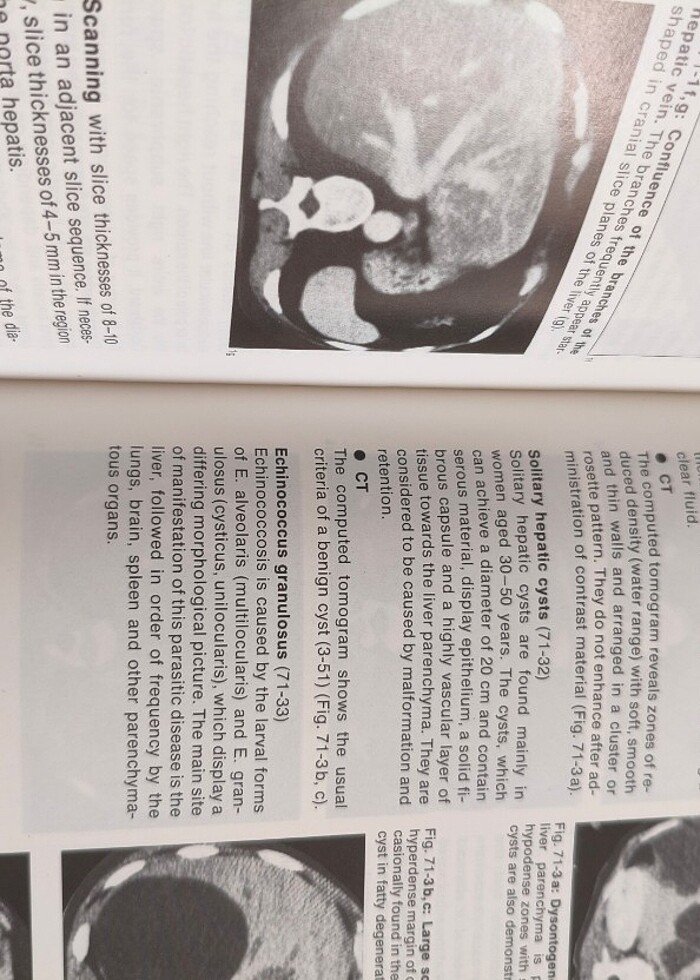 Tüm vücut tomografi  - Görsel 4