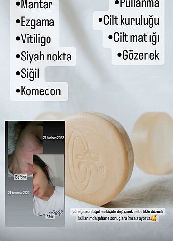 Kozmetik