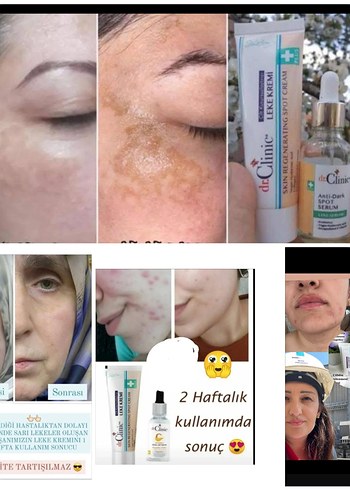 Dr. Clinic Leke Kremi ve Serum Seti