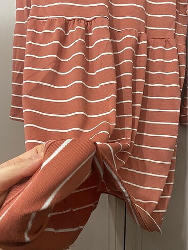 Çizgili tunik - Görsel 4