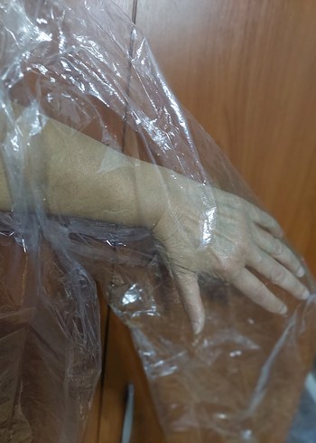 Şeffaf yağmurluk - Görsel 5