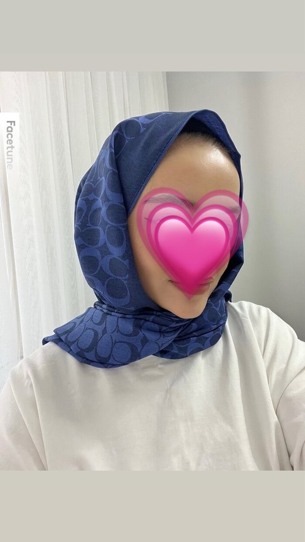 Yün ipektir 1 kez taktım - Görsel 2