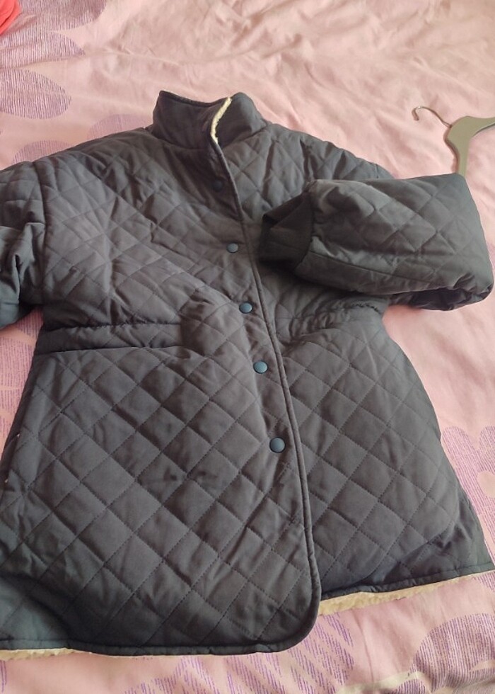 Mont tuylu - Görsel 3