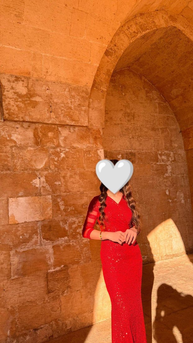 Kırmızı Parlak Elbise - Görsel 2