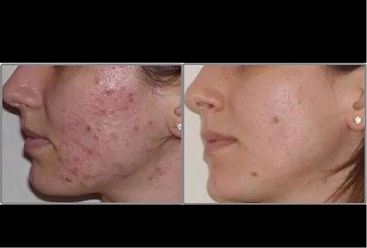 Beden Renk yüz ve vücut için güçlü peeling