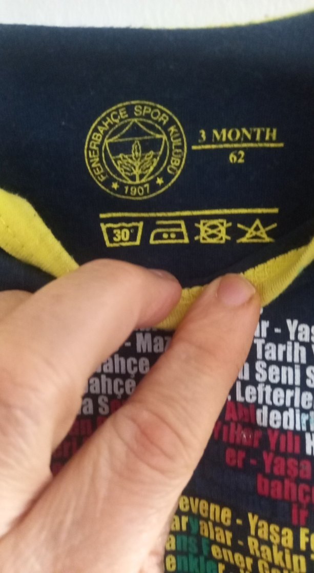 Sarı-Koyu Lacivert Baskılı Bebek Body - Görsel 2