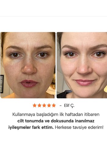 Epify Glutatyonlu Peeling Etkili Nemlendirici - Görsel 4