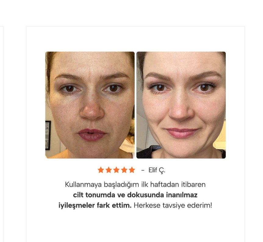 Epify Glutatyonlu Peeling Etkili Nemlendirici - Görsel 4