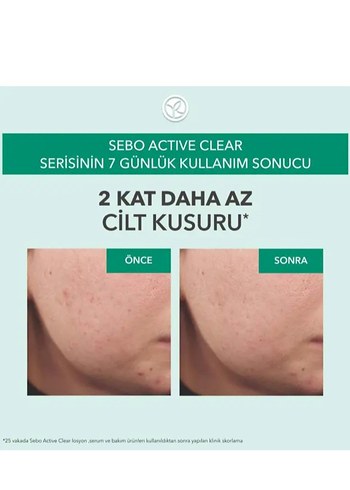 Yves Rocher Sebo Active Clear Yağ Dengeleyici Serum 30 ml - Görsel 3