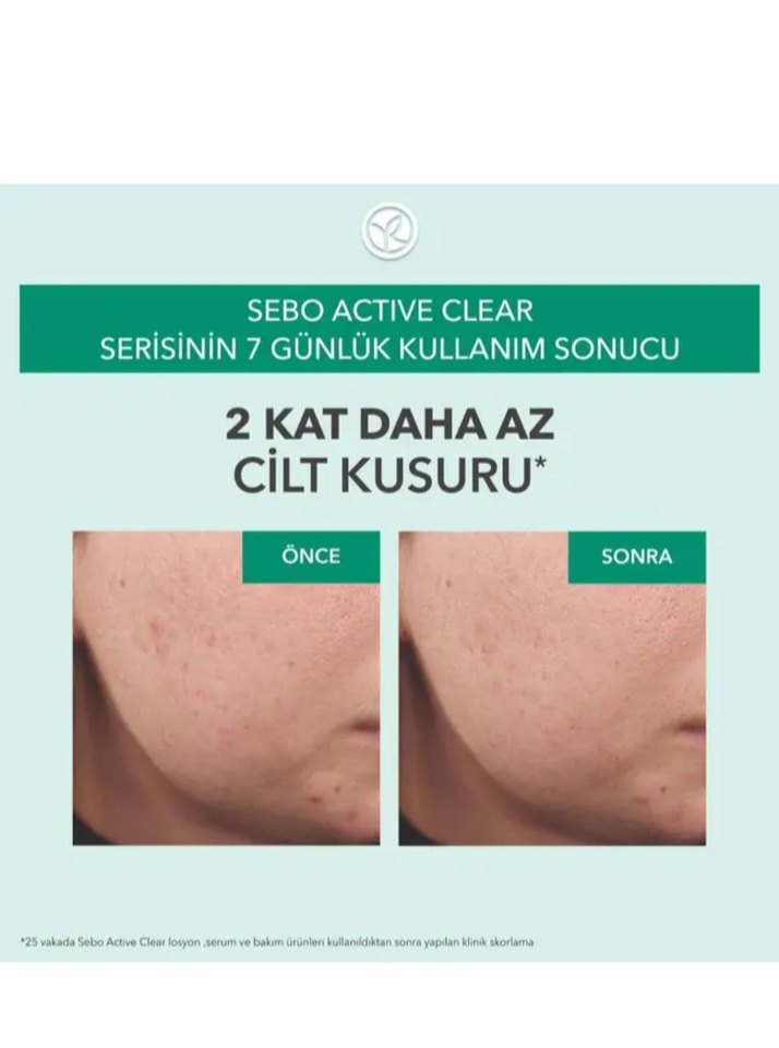 Yves Rocher Sebo Active Clear Yağ Dengeleyici Serum 30 ml - Görsel 3