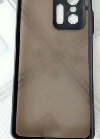 Xiaomi Telefon Kabı