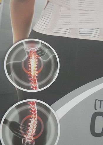 skolyoz korsesi - Görsel 3