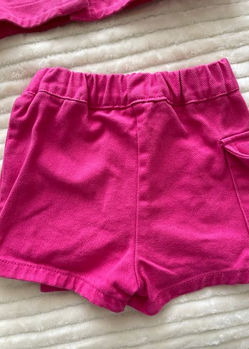 Düğmeli Pembe Kız Çocuk Eteği - Görsel 2