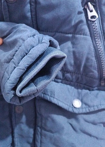 Erkek Çocuk Lacivert Düğmeli Mont - Görsel 4