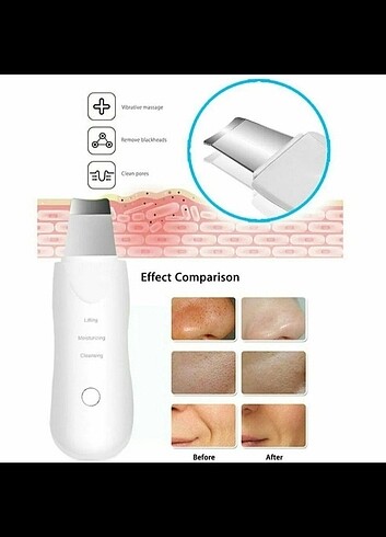 Beden Ultrasonik cilt spatula siyah nokta yüz temizleme