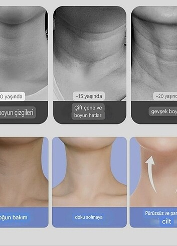 Beden Renk Yüz göz boyun germe kırışıklık giderici (EMS) gıdık,sarkma kırış