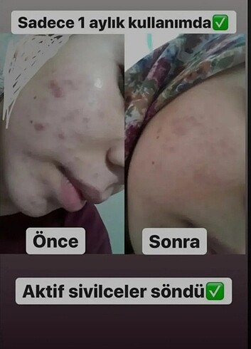 Gant Keçi sütlü sabun 