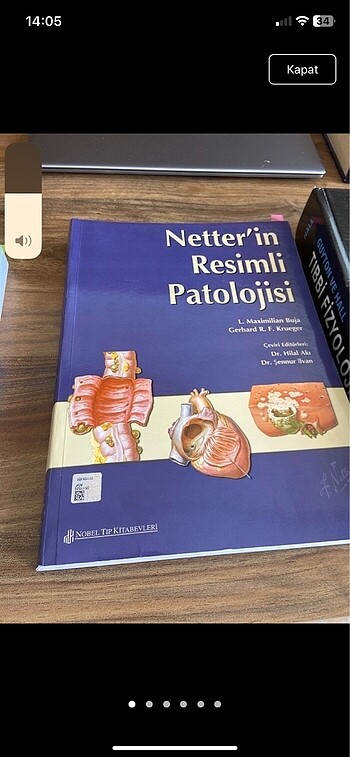 Netter Resimli Patoloji